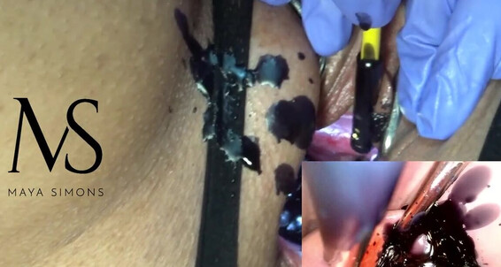 Сlips4Sale - Burning Cervix Simons Extreme With Candlep Extrema Maya Halloween Black