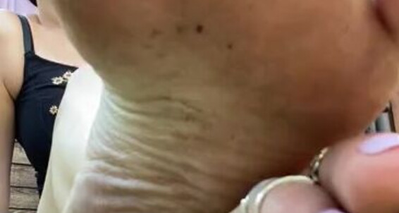 Feetwonders - Quite Whilst I However Rings Like And The This Family Made Onlyfans Home Pedi Clip At S Toe 9Tp Garden