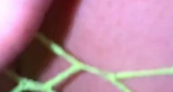 Bubblegum Toes - 2024 New Here Bubblegumtoes2 09 04 Foot Onlyfans In Time Youll Of A Fetish Days Its Ztrp See Me Before Episode Video For