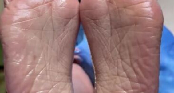 Deedeericanfeet, Video: Appreciate Some I For Oily Post Soles Then Thank As Awaiting Patiently Onlyfans It And Requested This U