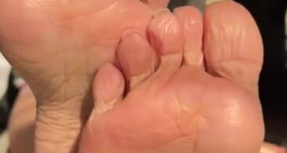 Deedeericanfeet - Requested Mmm Nude Onlyfans In As Toes