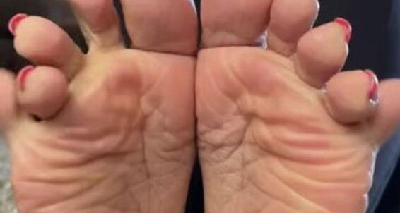 Deedeericanfeet - Toe Onlyfans Overlap Pinky As Requested