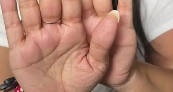 Cover Deedeericanfeet Onlyfans As Requested Some More Of My Wrinkly Palms
