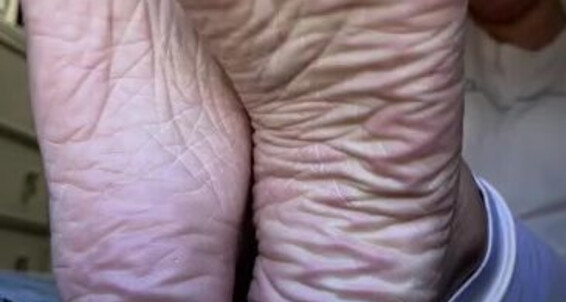 Deedeericanfeet - Onlyfans From Sooooo Wrinkly View This My Window Mmmmm Bedroom