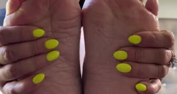 Deedeericanfeet - New Neon Goes Great Onlyfans Pedi My Yellow Mani Tan Wit