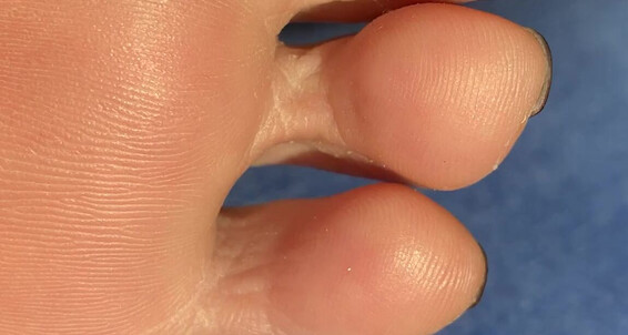 Goddess Suzie, Video: Goddesssuzie26 Under Onlyfans Toes 4K Close Up