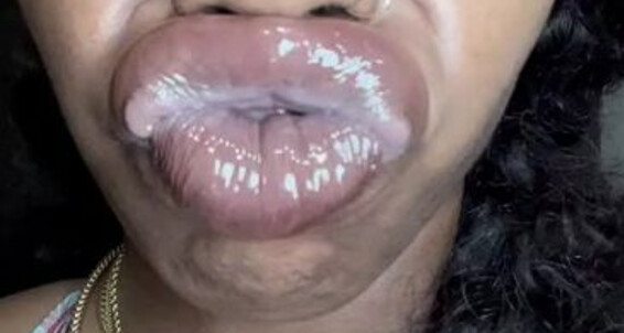 Biiggjuiccyfruit, Video: Eyes Huge Crosssed Onlyfans Enjoy Smelling Lip Pucker