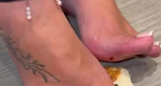 Footsiegalore, Video: Between Onlyfans Squished So Tasty Listen Asmr My Toes Friday And Those Sounds To Foodie