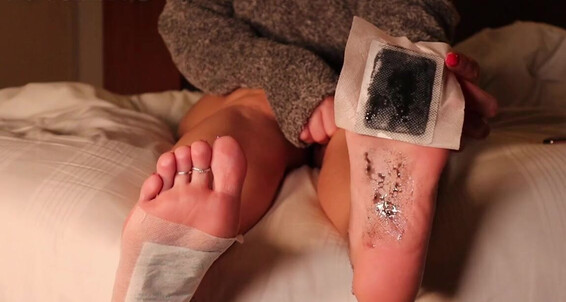 Footsiegalore - Toxins It Tried To Them Pads Detox Sunday Foot Self Onlyfans In And Out I Sleep You S Draw Some Meant Care