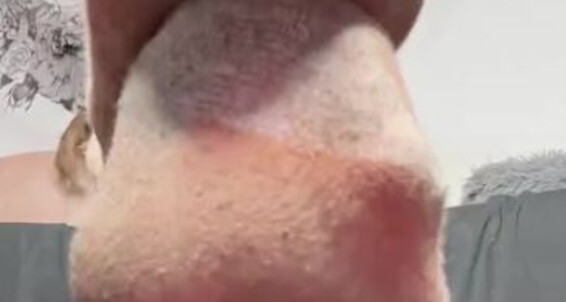 Thebarefoothooper - Requested Removal Memyselfnmysoles Sock Onlyfans Someone