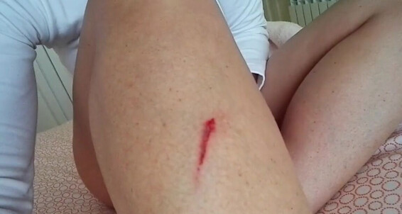 Kathia Nobili, Video: Deadly 2017 Onlyfans Kathianobilixx Video A4H 12 Findom 07 Injury