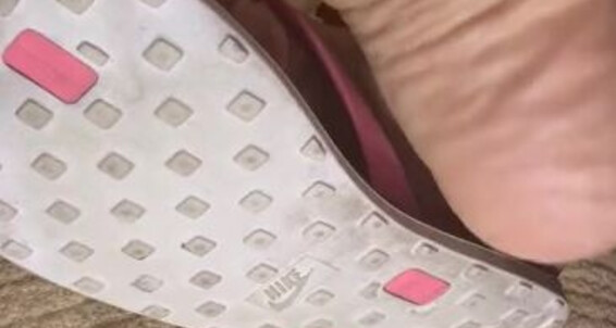 More And Dissatoes Wrinkles Onlyfans