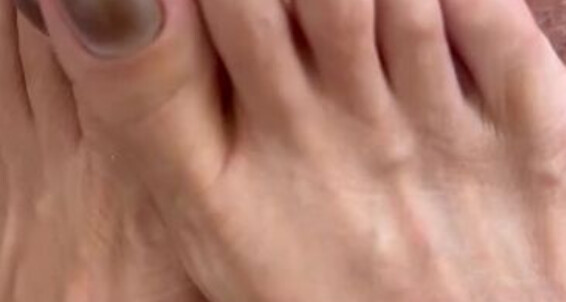 World Sexiest Feet - Pedi2 Worldsexiestfeet Onlyfans New