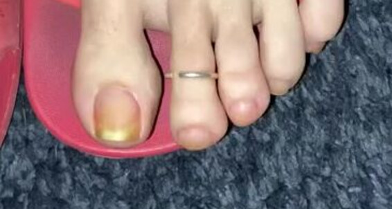 Catprincess - Then The Detox My Soak Always Onlyfans Catprincessfeet Tip Do Nailswhich Did Better First Like And I U Pedicures 2 Own