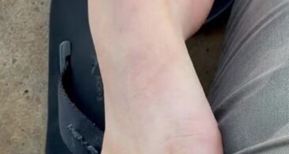 Pezinhos - Da Sempre Quase Pegos Vez Porm Aka Gostoso Footjob Dessa Fomos Onlyfans Amorafeetofc No Parque Amora Um