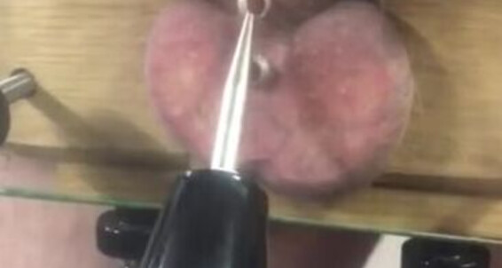 Vivienne L Amour, Video: Onlyfans Attachments Cuttingthroughflesh Aka Vlproductionsuk Violetwand 50 Searingpain With Nipp Electroplay Scarification L Vivienne Amour Vh