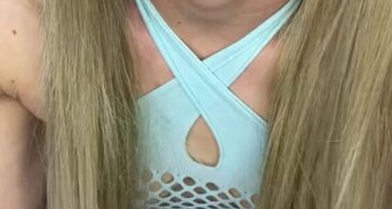 Froggee, Video: Braces Onlyfans Froggeevip
