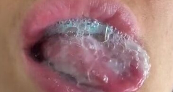 Froggee, Video: Braces Onlyfans Lovers Enjoy Froggeevip Play Cum