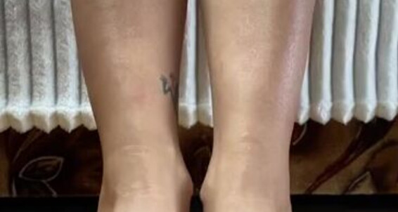 Froggee - Available Request And Color New Pedi Silver Froggeevip Onlyfans For Calls Customs Video By