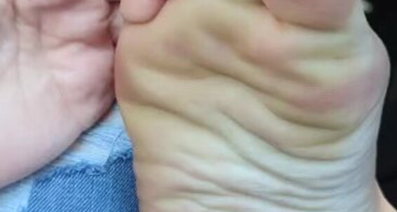 Pipersweetfeet - Little Because Made Forgot This I My Smack Thats Fuckin Hear Onlyfans Gum Teaser Apparently All