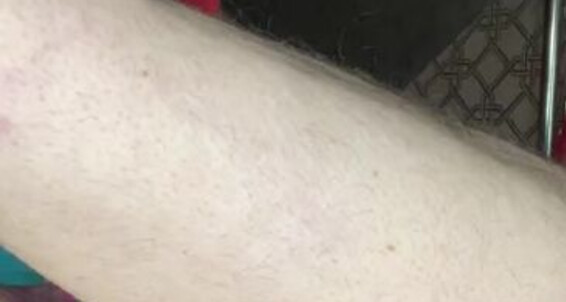 Ava It This Has Had Hole While My Aka Filling Mistress Onlyfans Avavonmedisin A Medisin But Its Since Bbc Slut S Been Von