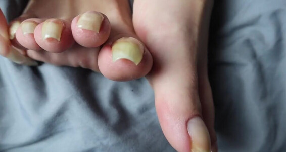 Vixen Arches, Video: Onlyfans My Ever At 4K Length Vixenarches Bare Measuring Their Longest Video Toenails Record