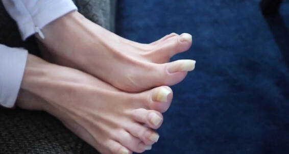 Vixen Arches - On 8 19Th After Growth Trimming My Recorded Me Months September Toenails Onlyfans Vixenarches Video Of