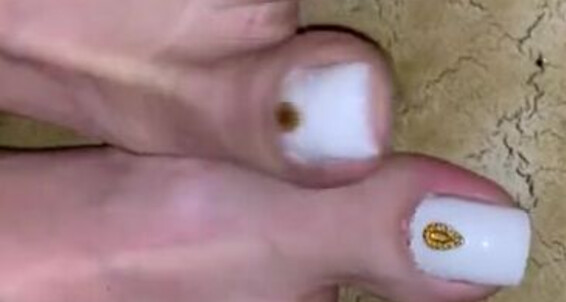 Vixen Arches, Video: Onlyfans White Toes Soles And Vixenarches Wet