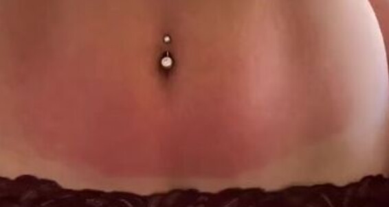 Sunburn Other 2024 Moringapaz Massive I Video Moringa Look The How Like Got Paz 11 Nicknamed But Onlyfans 17 A Day