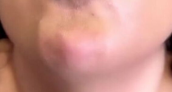 Lady Ayse, Video: Lady Titts Onlyfans Ladyayse My Nicknamed Ayse Big