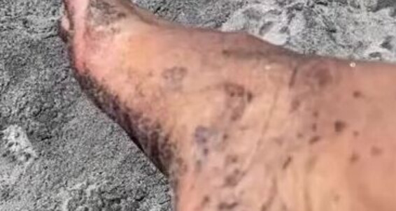 Mistressvblack, Video: Dirty Black Onlyfans V Nicknamed Feets Mistress