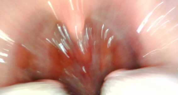 Gtsgoldenlace - Mouth Fuck Endoscope