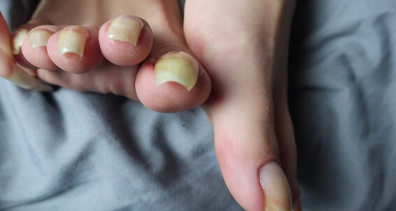 Vixenarches - Their Longest Ever At Record Bare Toenails K My Video Measuring Length