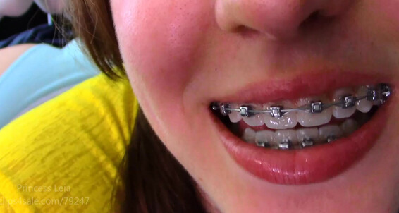 Joi Braces P Leias Princess Leiacm