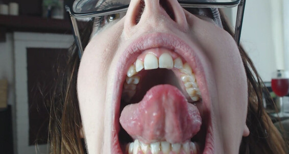 Cover Canadiansammy Roof Of Mouth Upper Teeth Hard Palate