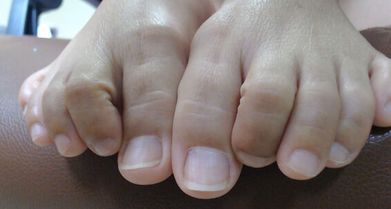 Fingers And Vid Asian Extreme Closeup Keymoonasian Toes