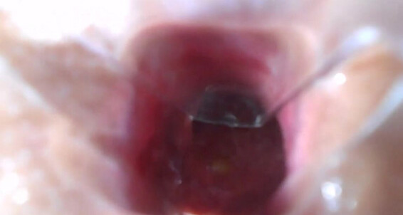 Helena_Moeller, Video: Anal Helena Of Moeller Macro Shooting