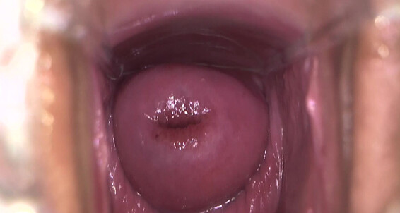 Mix, Video: 740 Ryder_4 Siterip Bailey