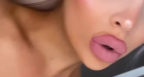 On And My Monday Dollybitch I Apprec Lips Would Getting Filler Done Jaw Cheeks